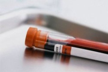 Смъртоносен щам на вируса на птичия грип обсади България
