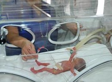 Бебе с тегло 400 г се роди в Смолян