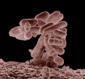 С бактериите &ndash; лошо, без тях &ndash; по-лошо