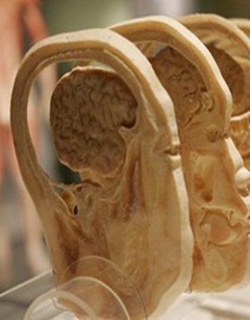 Цигарите и солта докарват инсулта