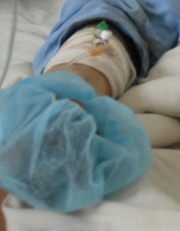 Трима, пострадали при пожари, са приети в Пирогов