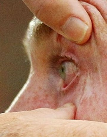 Микроробот освобождава лекарства директно в очите