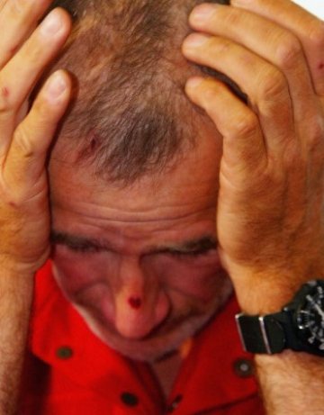 Обезболяващите &ndash; причина за нестабилна ерекция при мъжете