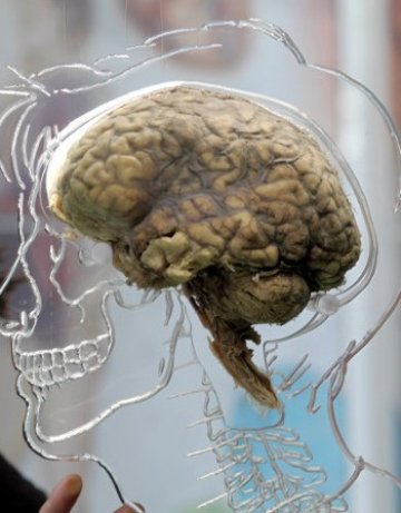 Протеин в мозъчните клетки &ndash; от ключово значение за аутизъм