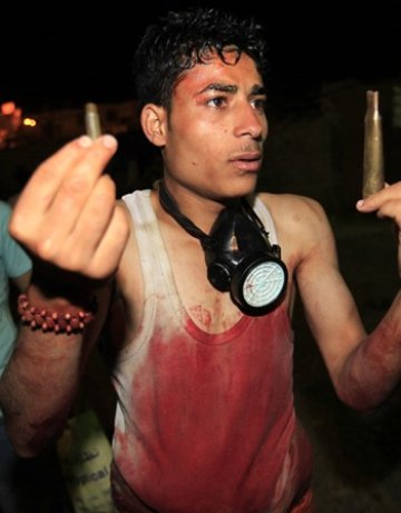 Един убит и 40 ранени в Сана