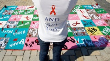 30 г. след първите случаи надежди за лечение на СПИН