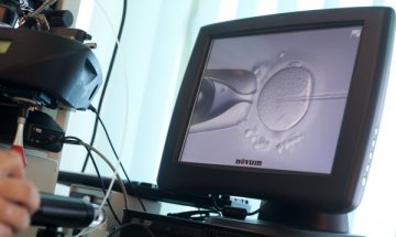 За аспектите на модерното лечение на безплодието 