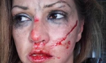 Сани Алекса – вече в безопасност, шведът и преди я удрял