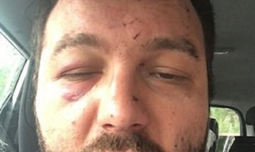 Британци пребиха зверски българин в Норич, возил ги в такси