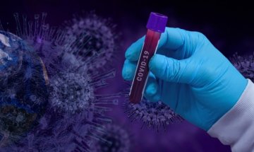 Заразен с COVID-19 персонал затвори детска градина в Ямболско