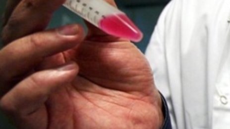 Не свински грип, а А (H1N1)