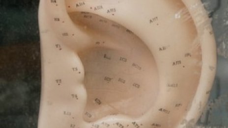 30 години със зъб в ухото