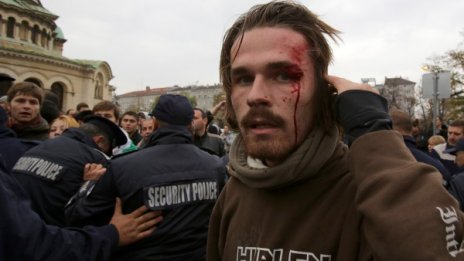 Окървавеният студент: Нямам проблем с главата 