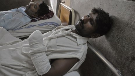 Заподозрени крадци в Пакистан твърдят, че в полицията им отсекли ръцете