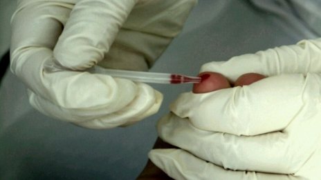 113 болни от СПИН са открити у нас тази година