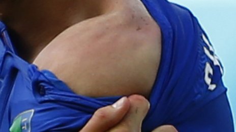 Периартрит на раменната става &ndash; какво е характерно