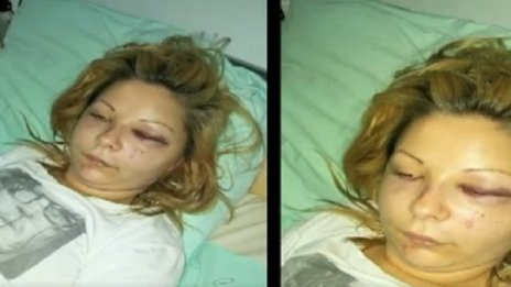 17-годишна твърди, че е пребита от кметски син