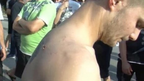 Пострадал при боя в Гърмен: Даваме на ромите седмица!