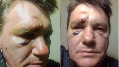 Преподавател във ВУЗ – жертва на полицейско насилие 