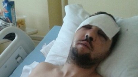 Пребитият журналист: Видях единия от нападателите!