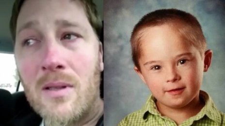 Бащина изповед: Даун не е заболяване! А обич, добрина...