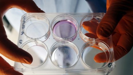 3D принтирани мозъчни тумори &ndash; стъпка към лечение?