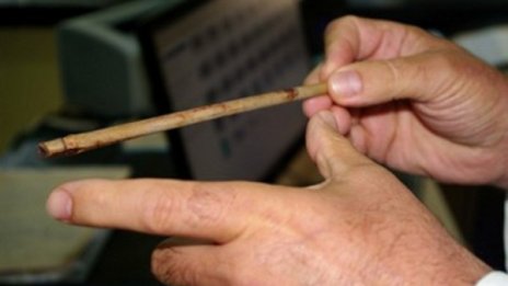 Като по чудо: Оцеля мъж с 15-сантиметрова пръчка в мозъка