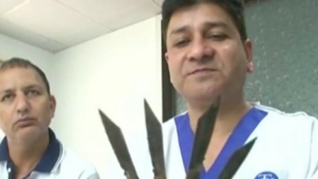 Извадиха 40 ножа от стомаха на мъж в Индия