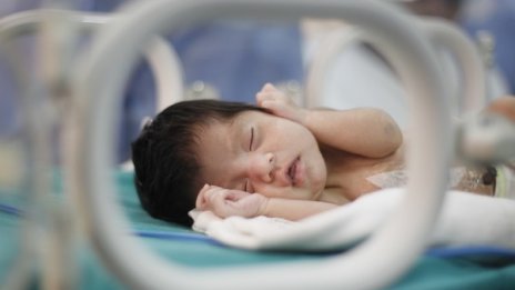 Лекарите не видели сиамските близнаци: Стара техника!