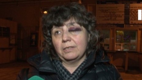 Жена с мозъчно сътресение след влаковия удар в Мездра