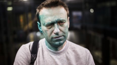 Навални загубил 80% от зрението си на едното око