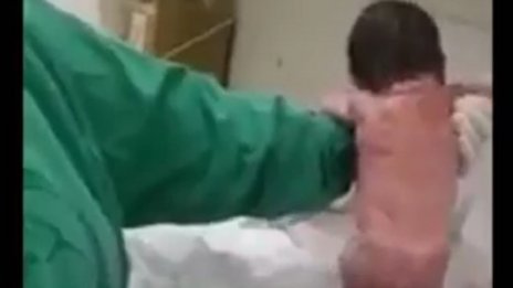 Чудо! Новородено проходи малко след раждането