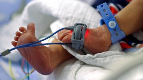 Липсват млади кадри, които да работят с недоносени бебета