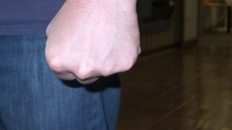 След побоя заради плацента: Бащата, набил лекарка - зад решетките