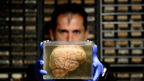 Клюки, подозрения... Женският мозък &ndash; по-активният!