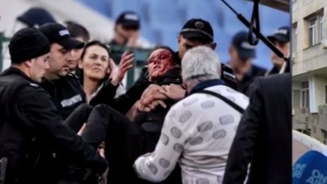 3 часа оперирали полицайката от мача, ще вижда, но...