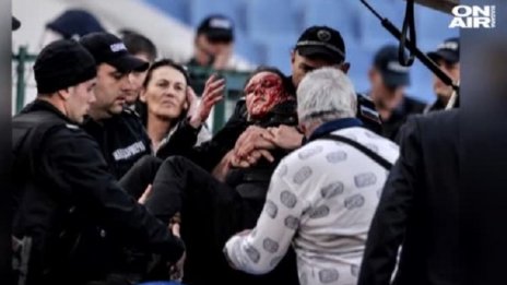 Колега на ранената полицайка: Повече самосъзнание!