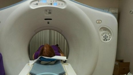 В XXI в. в Павликени: Дават звънец на пациенти при ползване на скенер