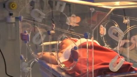 Новородено, но гигант &ndash; бебе с тегло 5,2 кг проплака в Русе