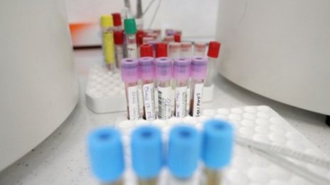 78 кандидати за ваксина срещу COVID 19, пробват първите 5 варианта