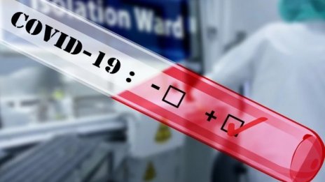 Тестват работещите в Спешна помощ в Пловдив за коронавирус