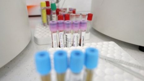 Започва лечение с кръвна плазма и озонотерапия в Северна Македония
