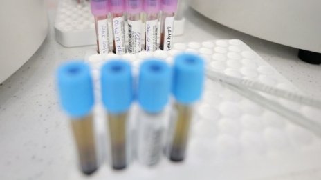 Пациентите с коронавирус в Русия вече са над 110 000