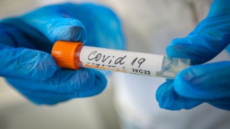 Коронавирусът нямало да изчезне през лятото