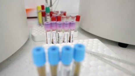 За симптомите на коронавируса - разказва излекувал се лекар