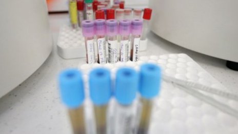 Перничанин с положителна проба за COVID-19 и след карантина