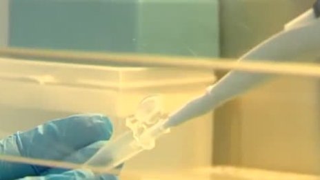 Какви са рисковете за хора с хепатит по време на пандемия?