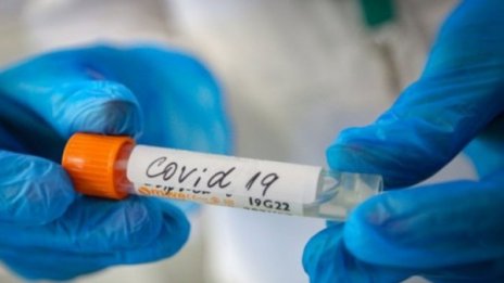 17 нови случаи на коронавирус у нас, починали са трима 