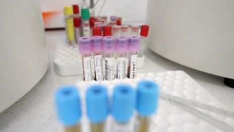 14 са новите заразени с коронавирус у нас, починал е един човек