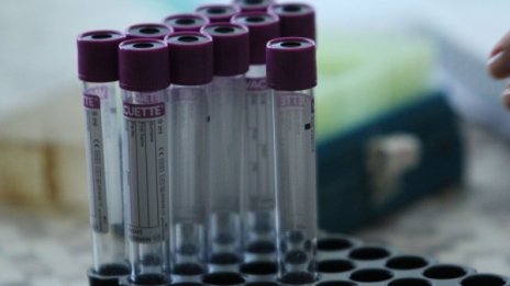 105 са новите случаи на коронавирус у нас, а четирима са починали